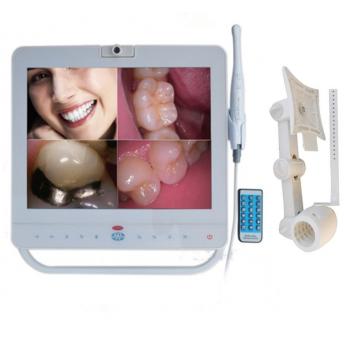 MD1500 15 pulgadas monitor dental + sistema de cámara oral intraoral cableada VGA + VIDEO Puerto