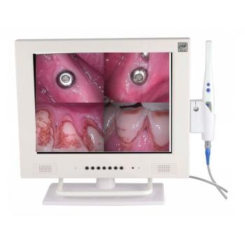 Alta Resolución MLG® M-958A WIFI Intra Oral Camera 15 PulgadaLCD 1/4 SONY CCD