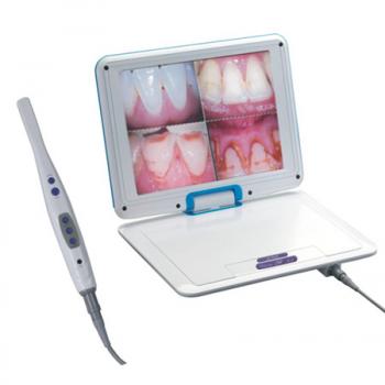 12.1 Pulgada LCD Alta Resolución 1/4 SONY CCD Dental Cámara intraoral M-968