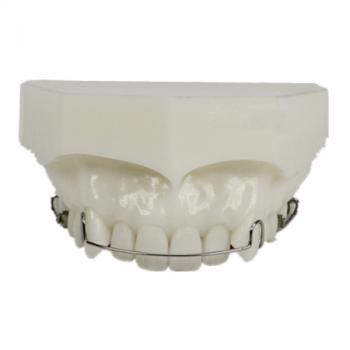 Modelo de ortodoncia Mantenimiento de tratamiento M3007