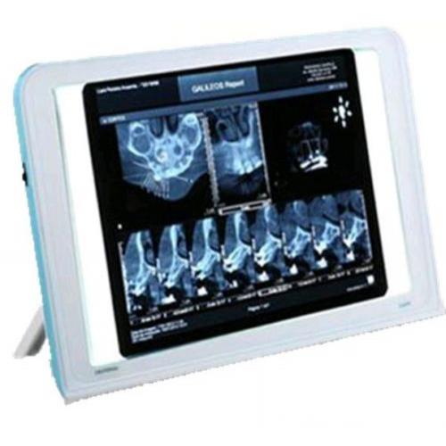 Dental X-Ray Tipo de Cine de Visor de Cajas de la Vista la Pared del LED Iluminado Turística de Montaje Luna