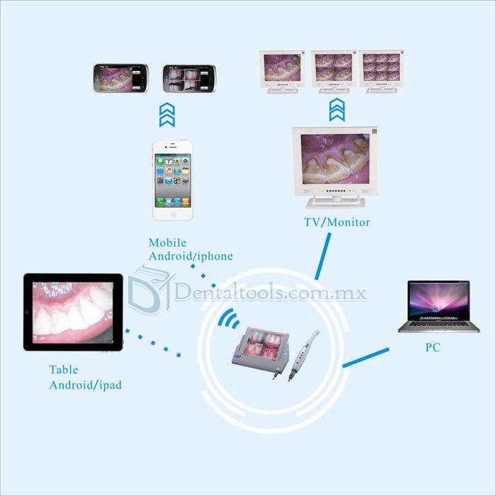 CF-988A Cámara Intraoral Wifi con Cable 8 Pulgadas LCD Minotor M-868