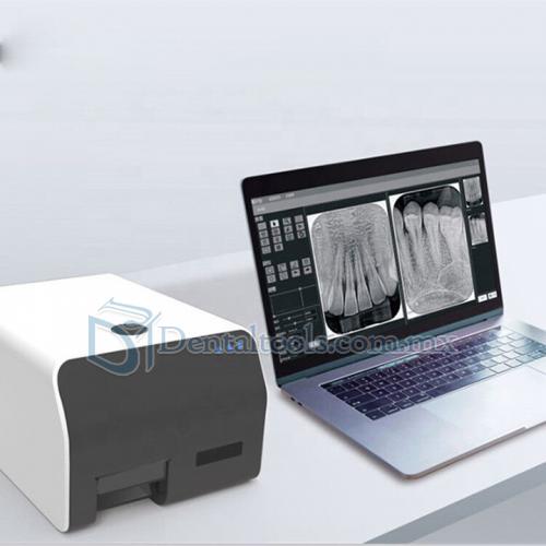 VRN Escáner de placas de fósforo dental scanner de placas de fósforo radiología digital 