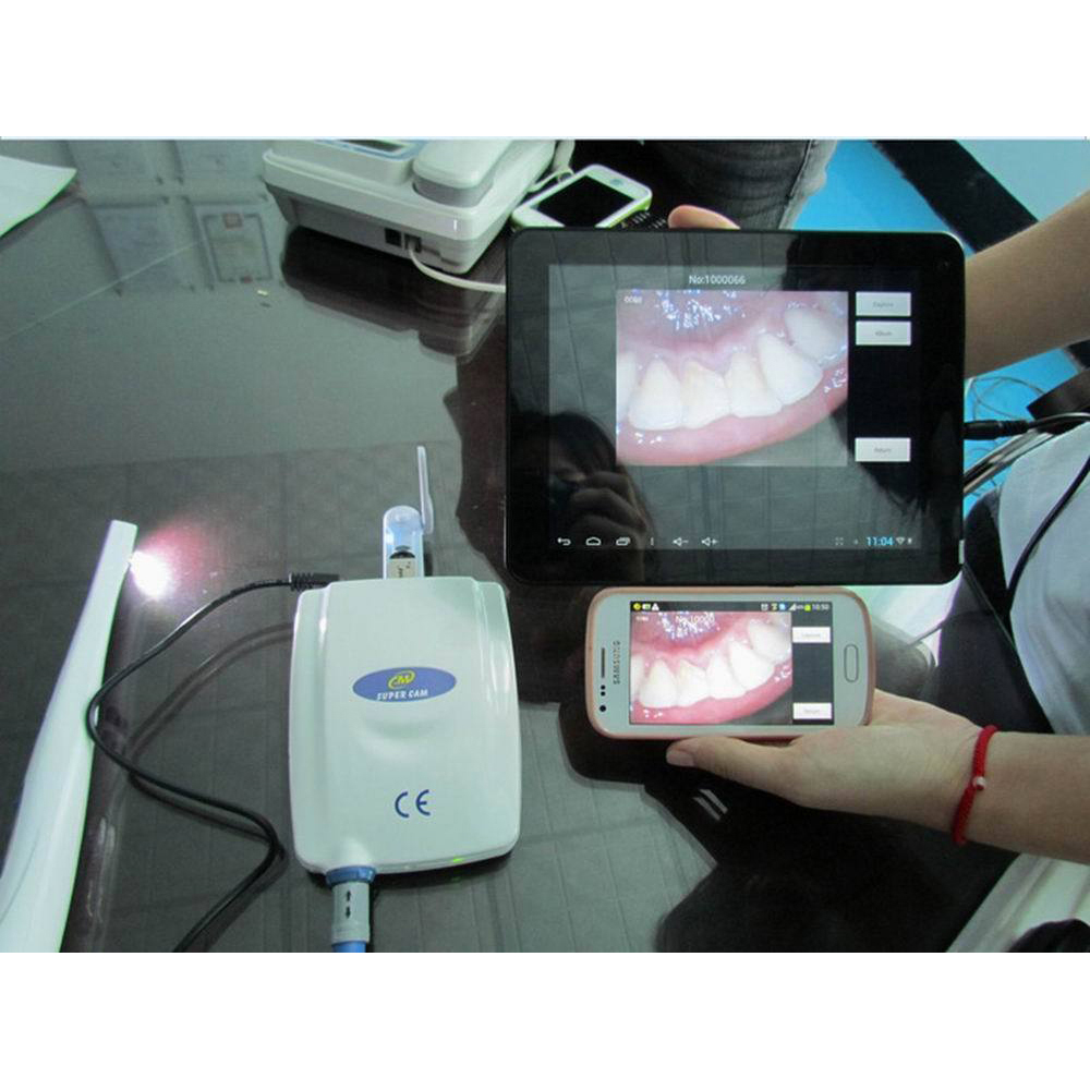 MLG M-888 Cámara intraoral con cable y sensor CCD Sony con salidas USB Video y VGA