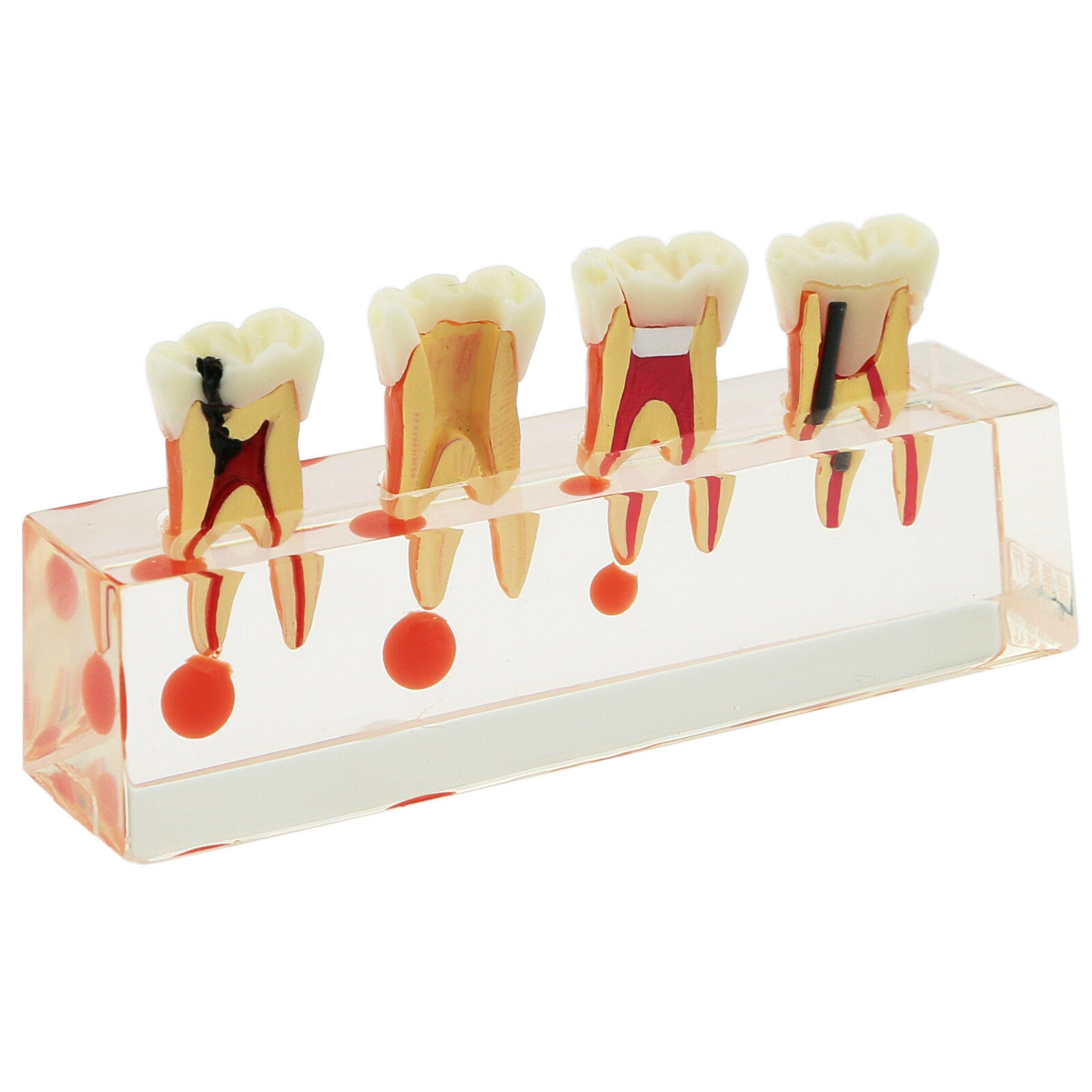 Modelo didáctico de endodoncia con 4 etapas del tratamiento de conductos 4018-01