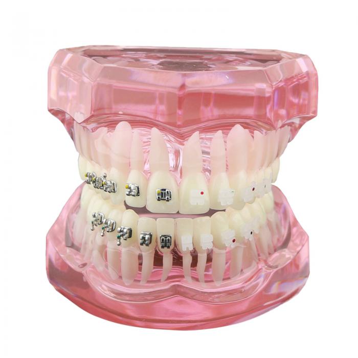 Modelo de ortodoncia con brackets metálicos y cerámicos para enseñanza 3003