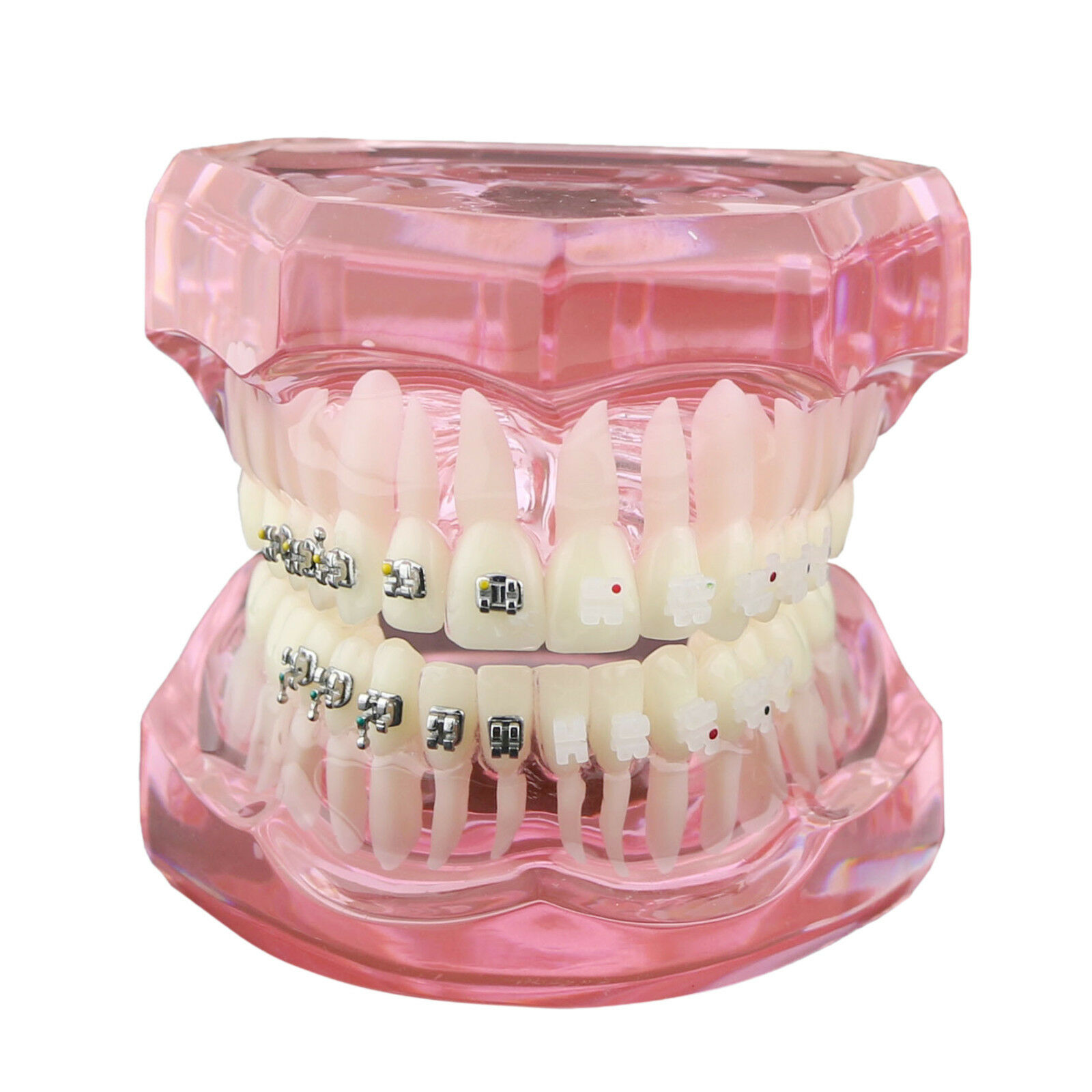 Modelo de ortodoncia con brackets metálicos y cerámicos para enseñanza 3003