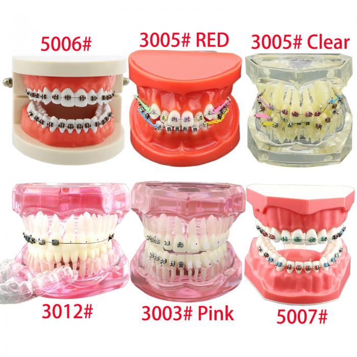 Modelo de ortodoncia con brackets metálicos cerámicos y autoligables con tubos y cadena elástica