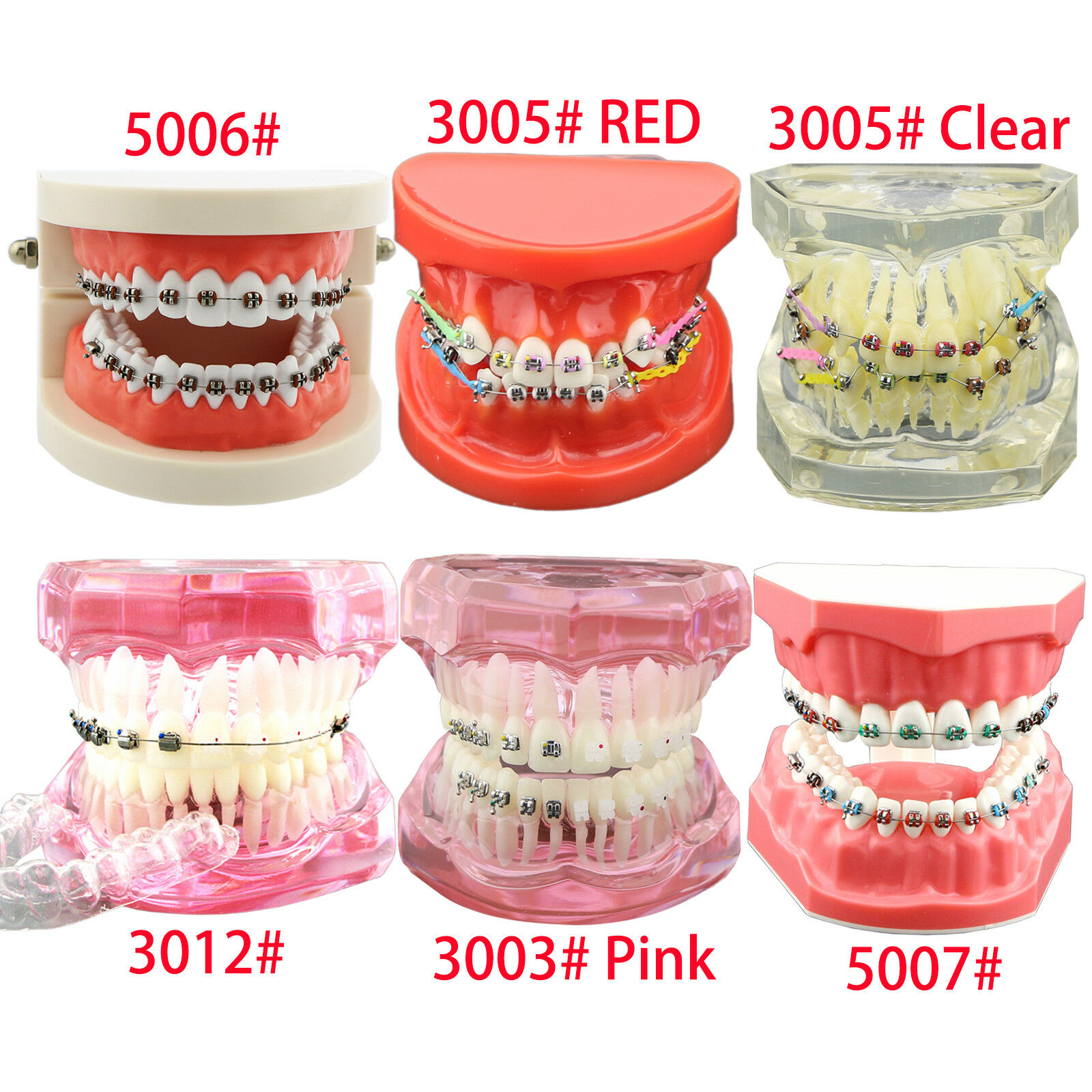 Modelo de ortodoncia con brackets metálicos cerámicos y autoligables con tubos y cadena elástica