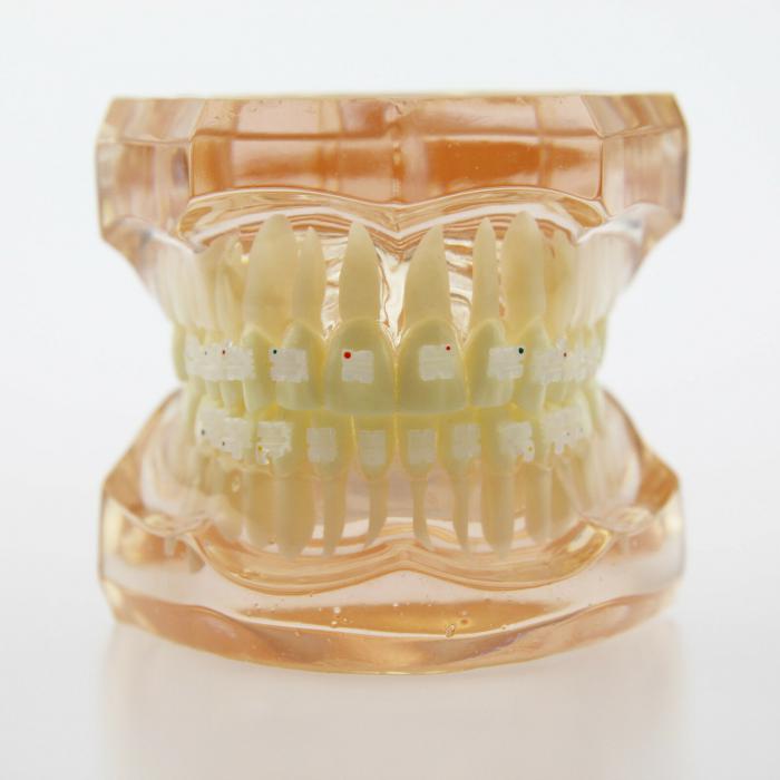 Modelo didáctico de ortodoncia con brackets cerámicos 3002