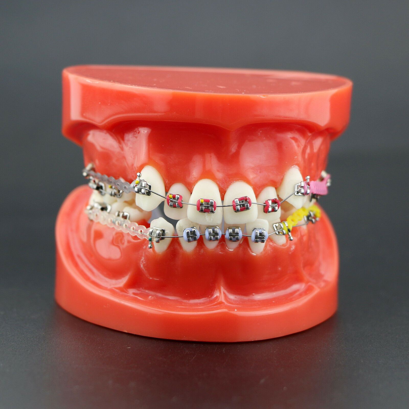 Modelo de ortodoncia con brackets metálicos arco ligaduras y cadena elástica 3005R