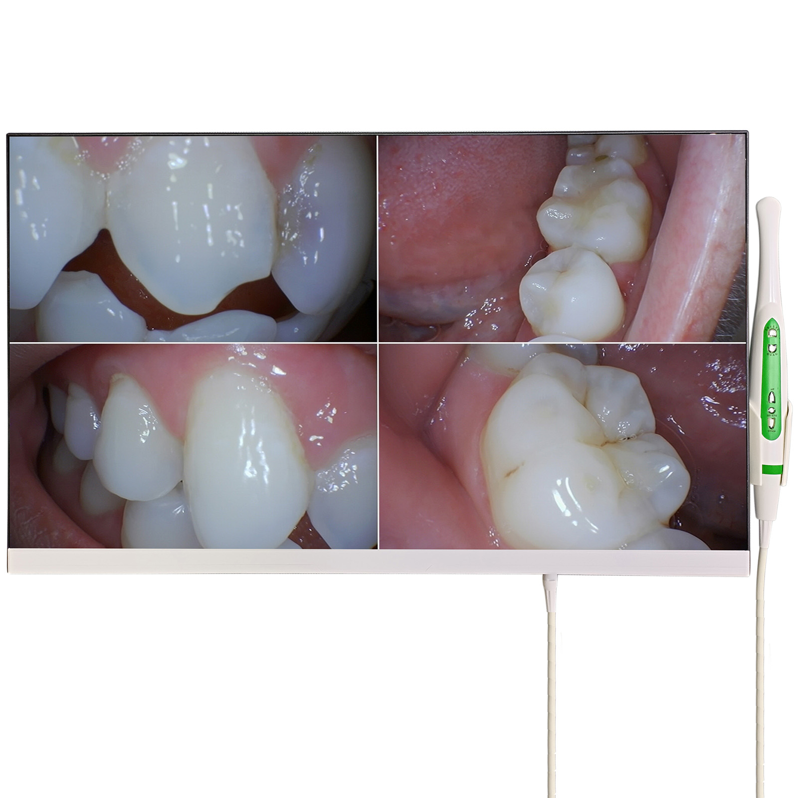 Magenta YF-2400M Cámara intraoral con monitor de 24