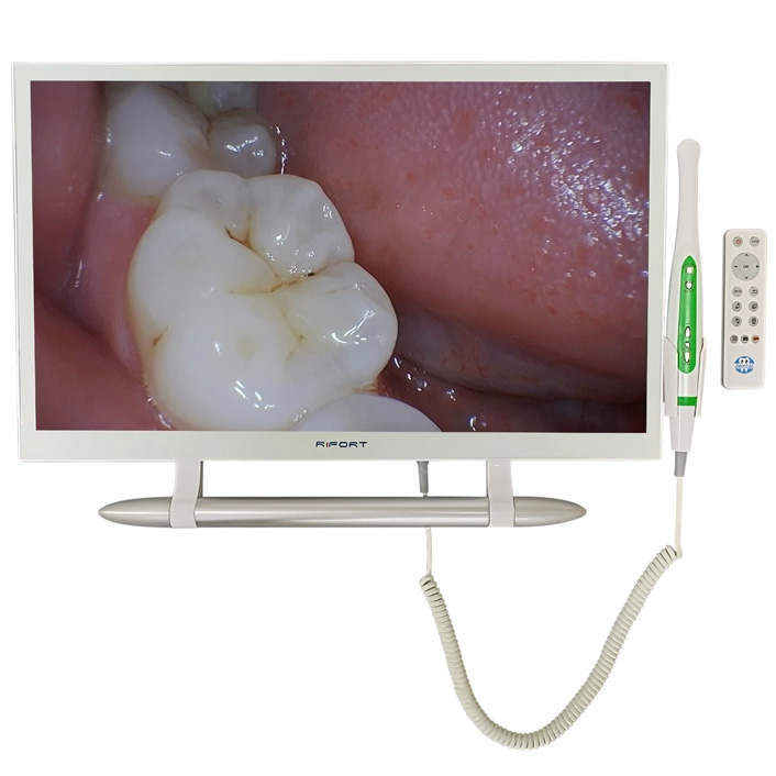 Magenta YF-2200M Cámara intraoral WiFi con monitor de 21.5