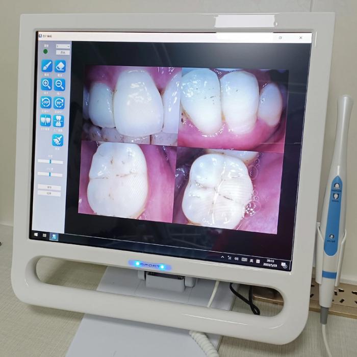 Magenta YF-1700P+ Cámara intraoral con pantalla táctil de 17"