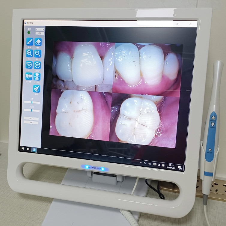 Magenta YF-1700P+ Cámara intraoral con pantalla táctil de 17