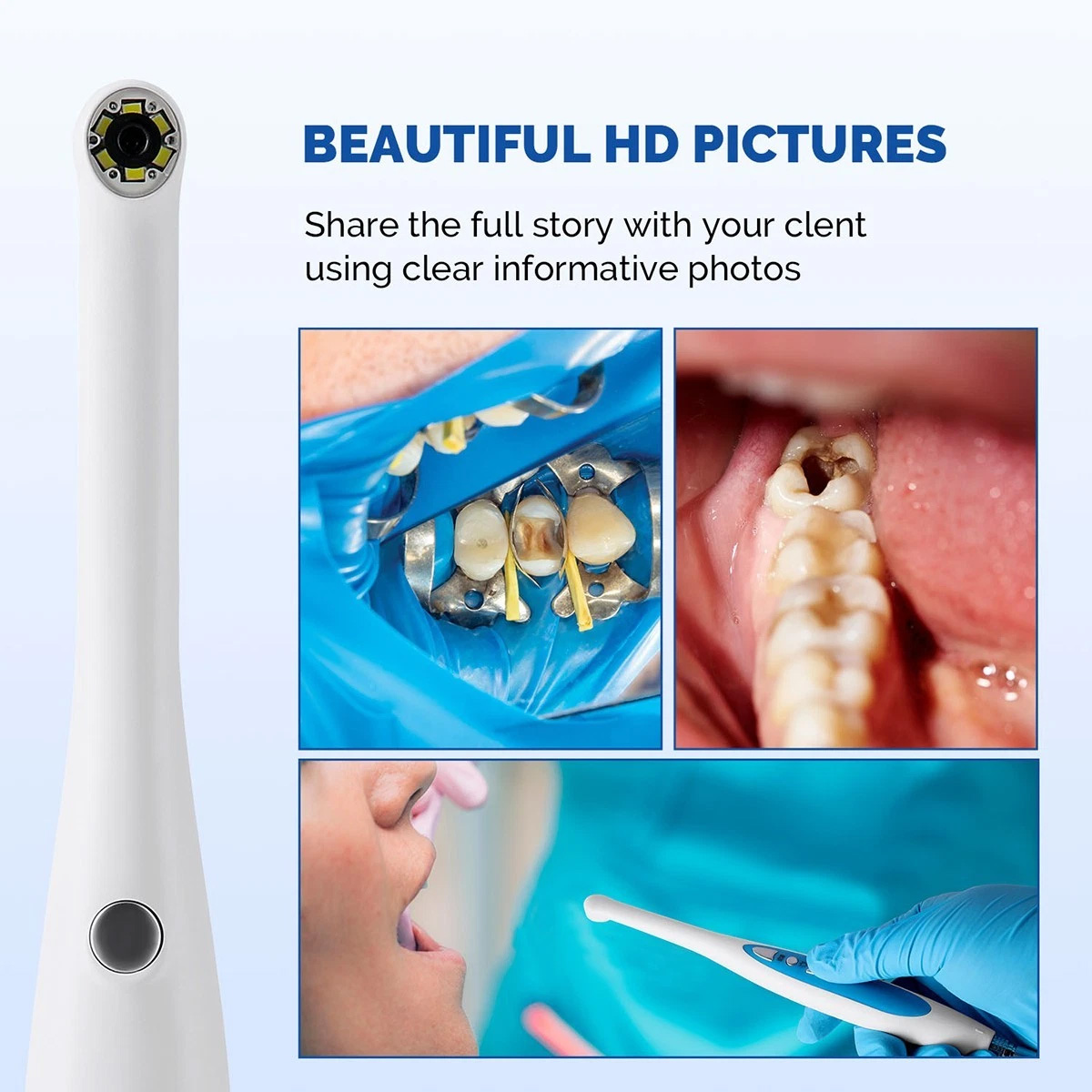 Magenta MD280 Cámara intraoral USB HD 720P compatible con Windows 10 y 11