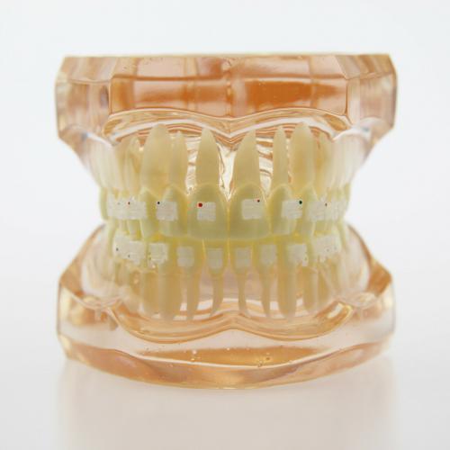 Modelo didáctico de ortodoncia con brackets cerámicos 3002