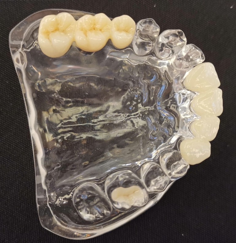 1 Unidad Bloque de zirconia multicapa de laboratorio Dental 3D, bloque de cerámica CAD/CAM