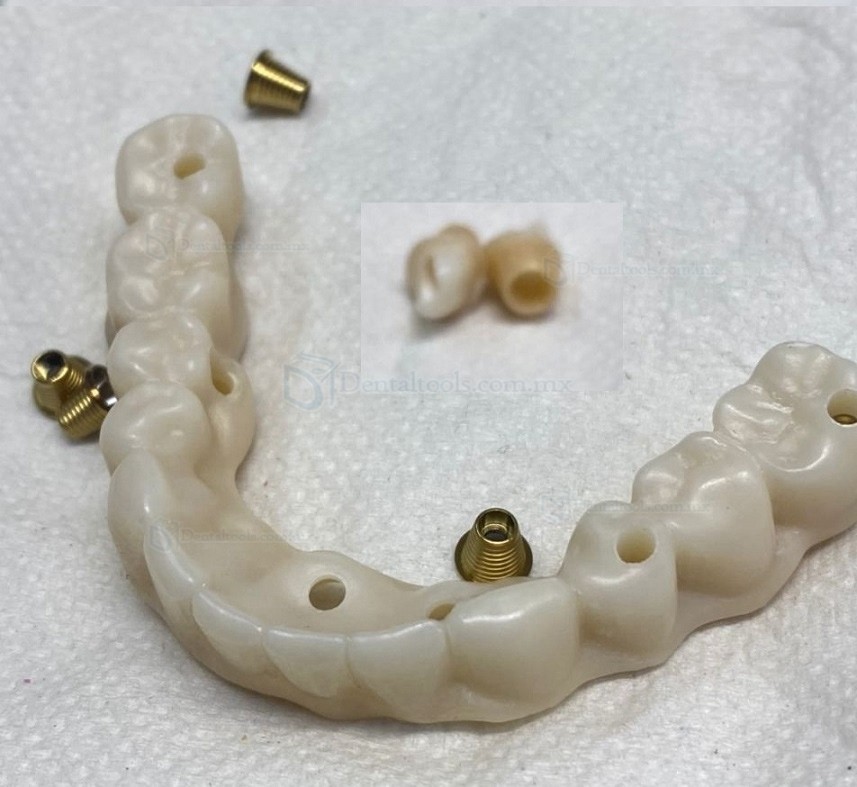 1 Pieza 3D ProMax Zirconia Bloque Laboratorio Dental CAD/CAM Bloque de Cerámica