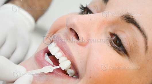 Instrucciones tras blanqueamiento dental