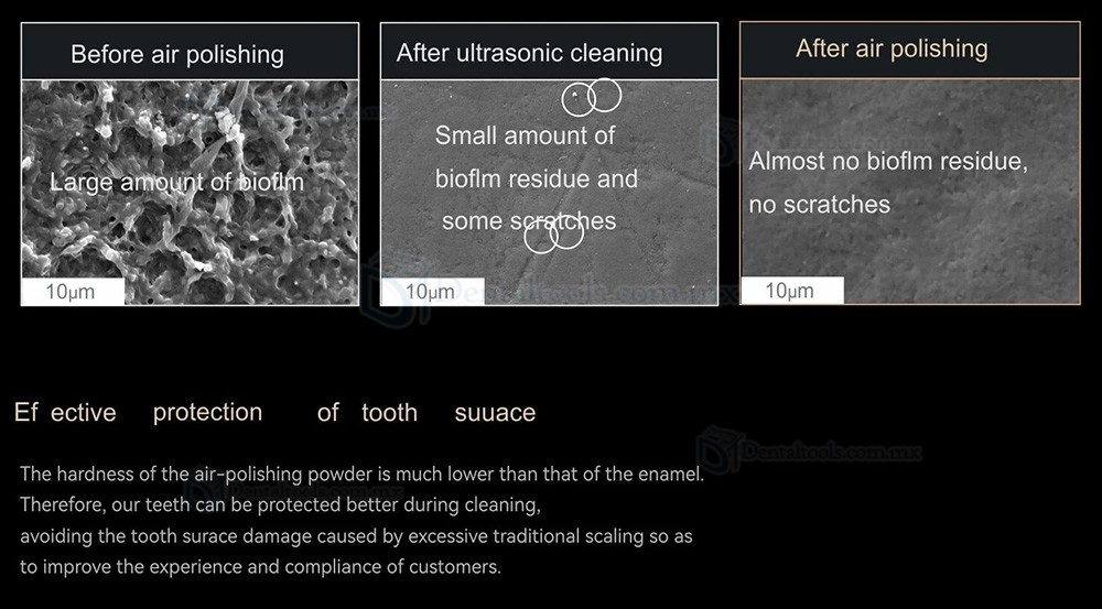 Woodpecker AP-H Plus Aeropulidor Dental Supragingival / Subgingival