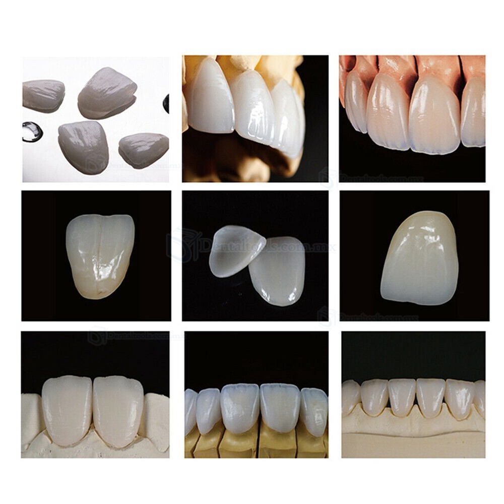 5Pcs B40 Bloques Dentales de Litio Dilicado E-max HT/LT CAD CAM para Sirona Cerec