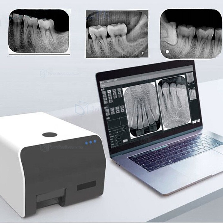 VRN Escáner de placas de fósforo dental scanner de placas de fósforo radiología digital 