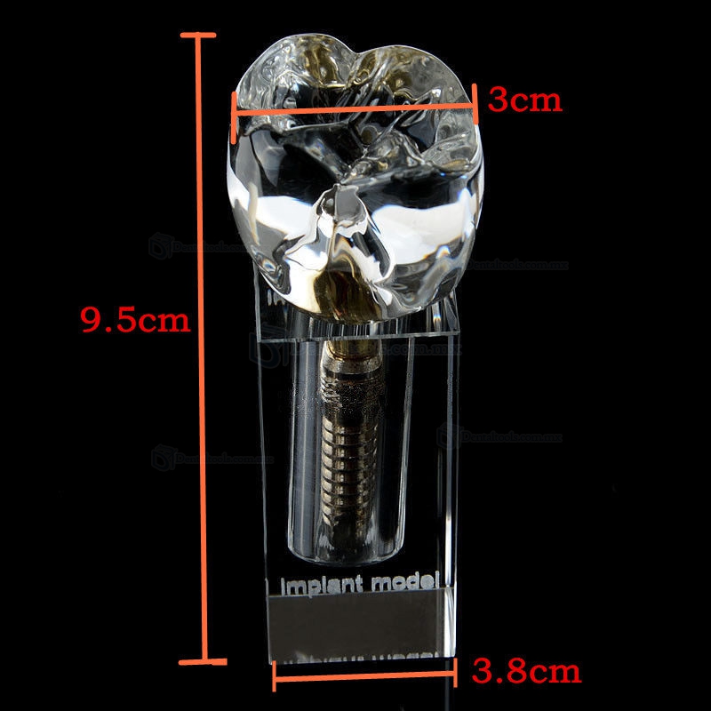 Modelo Cristal de implante dental M2019-II