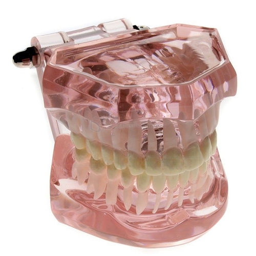 Modelo dental M-3004 restauración lingual