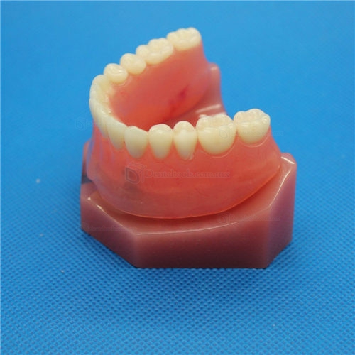 Modelo dental M-6007 Reparación del implante dental