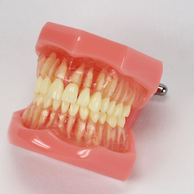 Modelo dental Extraíble Estándar
