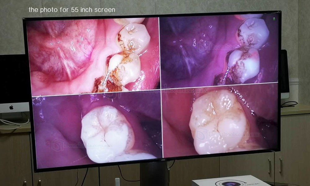 Magenta MD4000 Cámara intraoral digital con sensor CMOS y salidas VGA y HDMI Magenta MD4000 Cámara intraoral digital con sensor CMOS y salidas VGA y HDMI