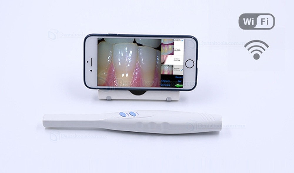 Super Cam CF-682 Cámara intraoral inalámbrica con WiFi Super Cam CF-682 Cámara intraoral inalámbrica con WiFi