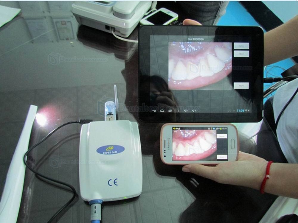MLG M-888 Cámara intraoral con cable y sensor CCD Sony con salidas USB Video y VGA MLG M-888 Cámara intraoral con cable y sensor CCD Sony con salidas USB Video y VGA