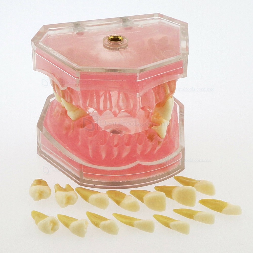 Tipodonto dental para ense&ntilde;anza con 28 dientes removibles 4004