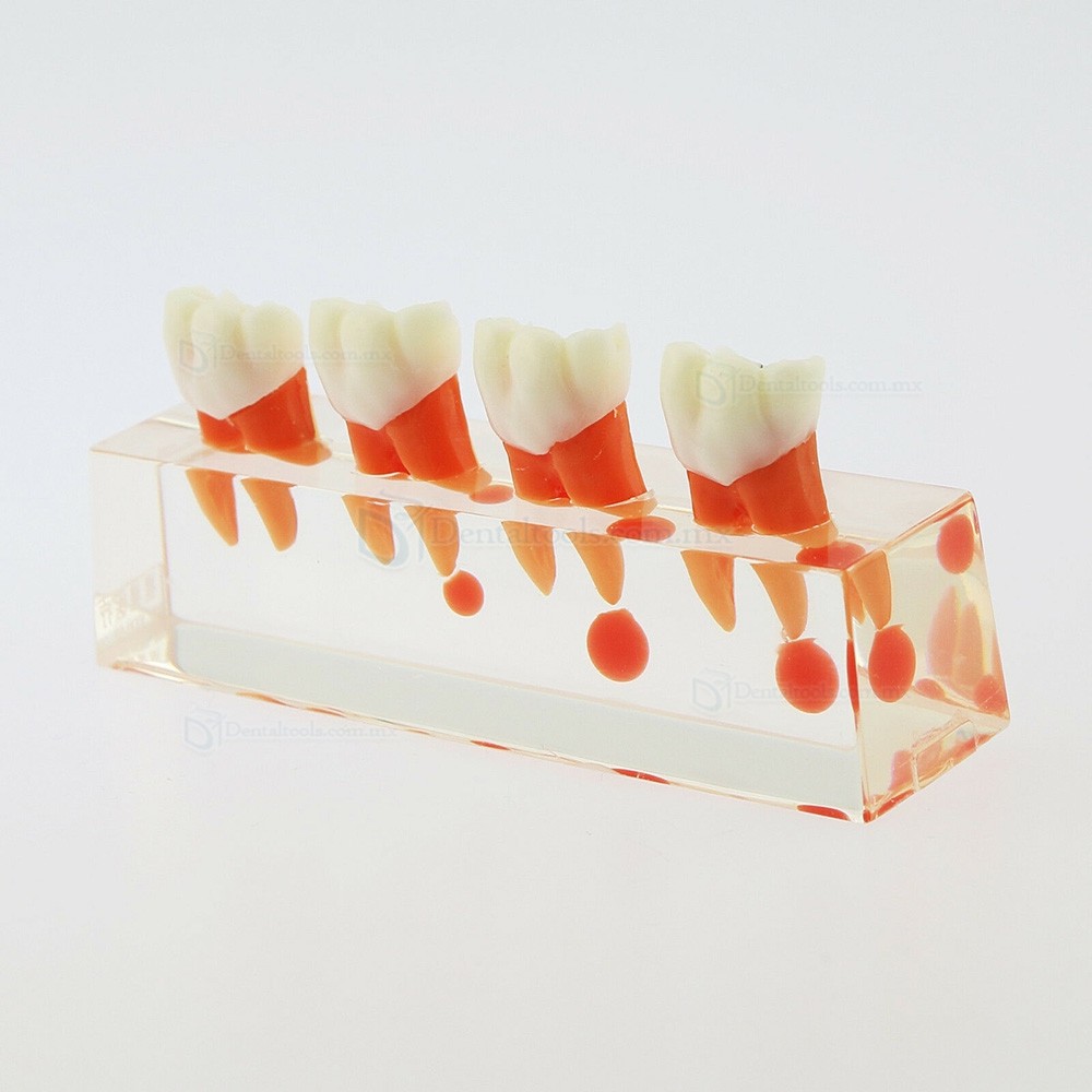 Modelo did&aacute;ctico de endodoncia con 4 etapas del tratamiento de conductos 4018-01