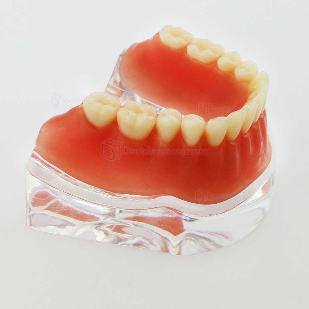 Modelo dental de mandíbula con 4 implantes para demostración 6008 Modelo dental de mandíbula con 4 implantes para demostración 6008