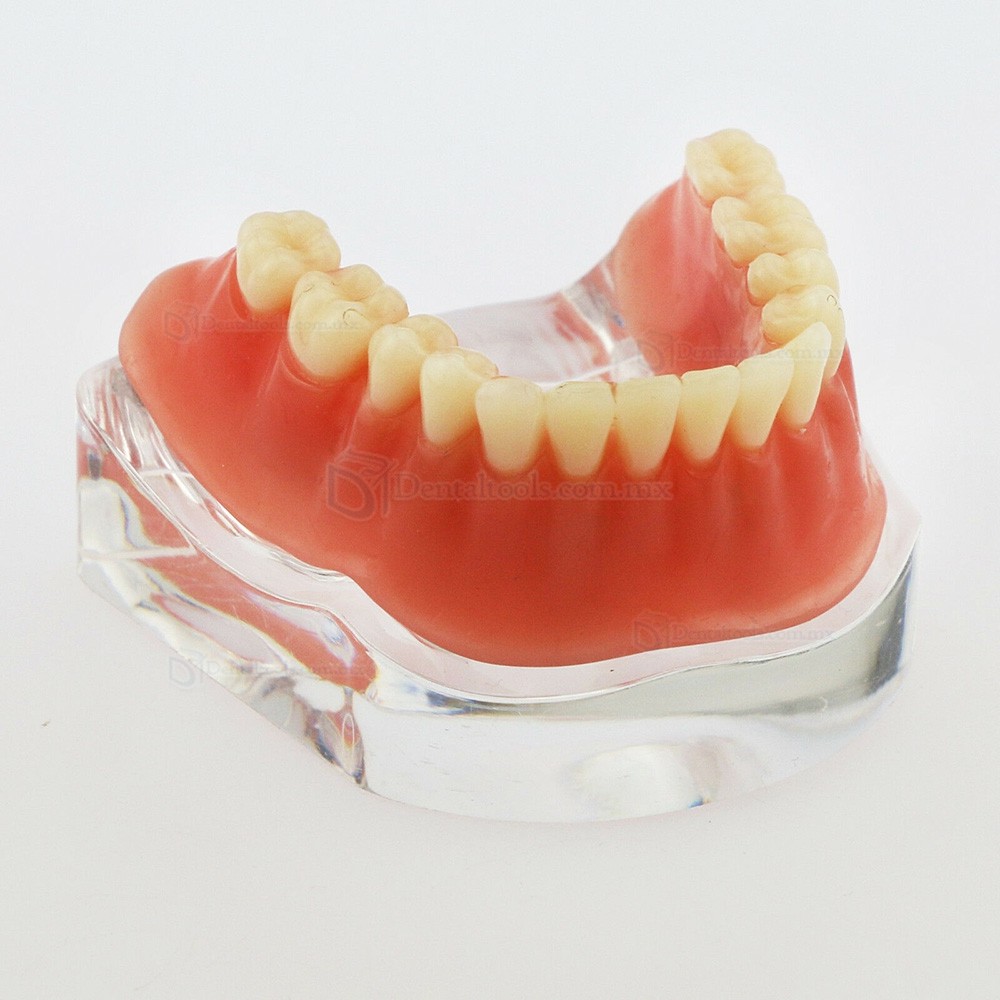 Modelo dental de mandíbula con 4 implantes para demostración 6008 Modelo dental de mandíbula con 4 implantes para demostración 6008
