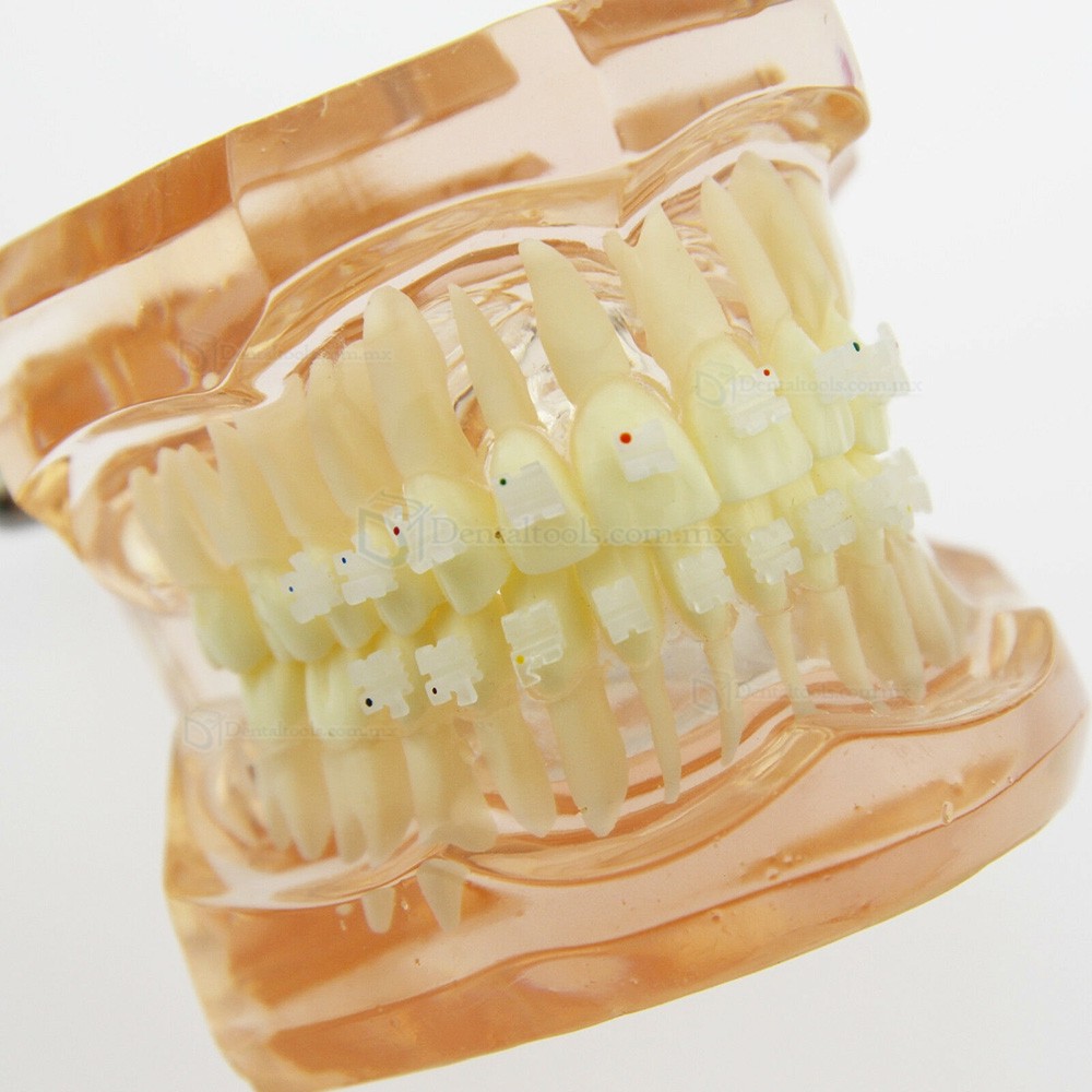 Modelo didáctico de ortodoncia con brackets cerámicos 3002 Modelo didáctico de ortodoncia con brackets cerámicos 3002