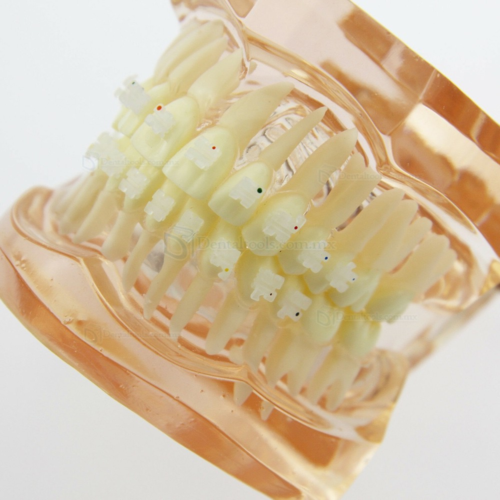 Modelo didáctico de ortodoncia con brackets cerámicos 3002 Modelo didáctico de ortodoncia con brackets cerámicos 3002