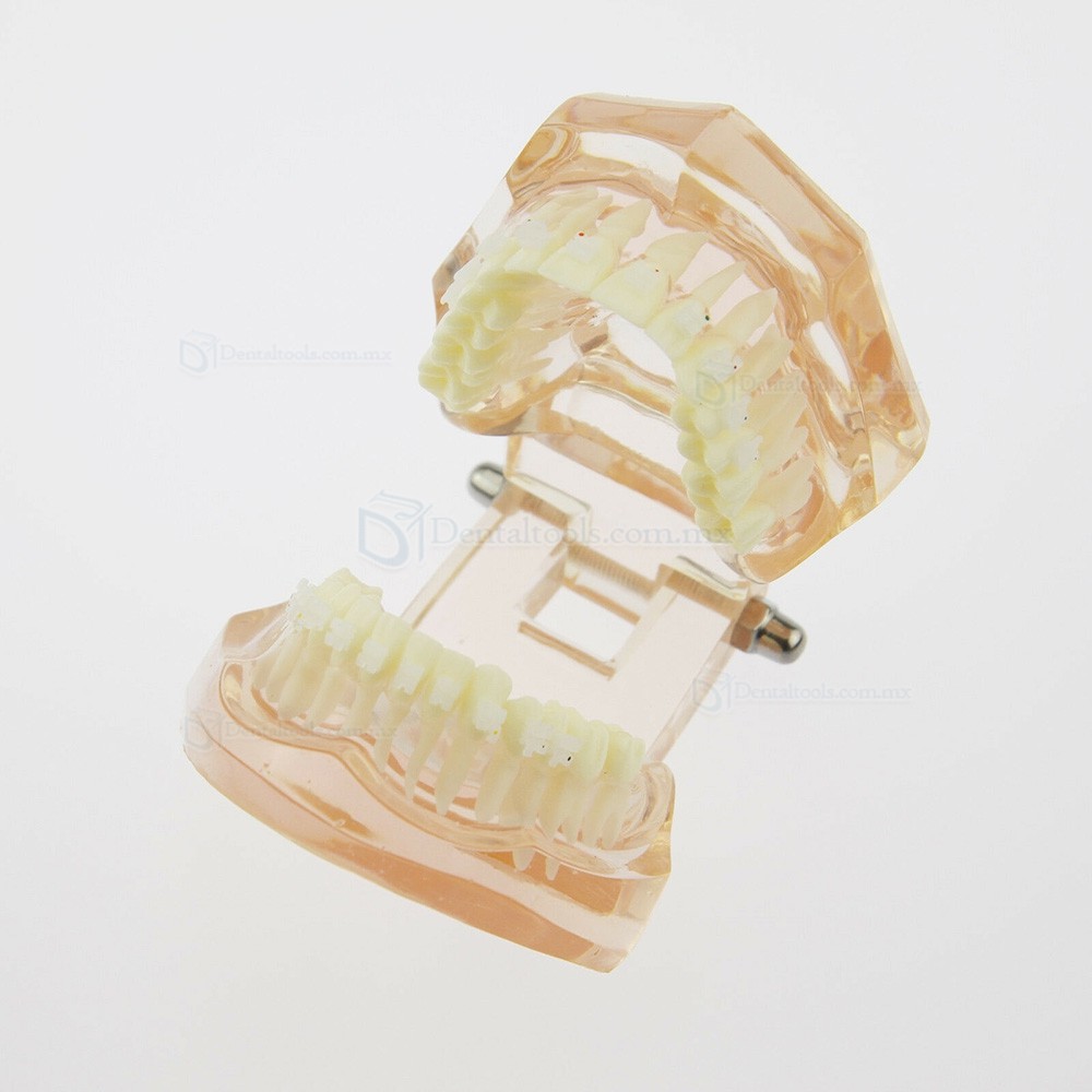 Modelo didáctico de ortodoncia con brackets cerámicos 3002 Modelo didáctico de ortodoncia con brackets cerámicos 3002