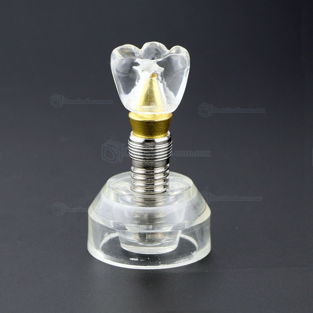 Modelo demostrativo de implante dental transparente desmontable ampliado 2.5 veces Modelo demostrativo de implante dental transparente desmontable ampliado 2.5 veces
