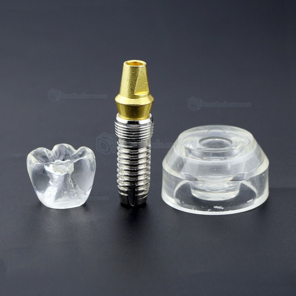 Modelo demostrativo de implante dental transparente desmontable ampliado 2.5 veces Modelo demostrativo de implante dental transparente desmontable ampliado 2.5 veces
