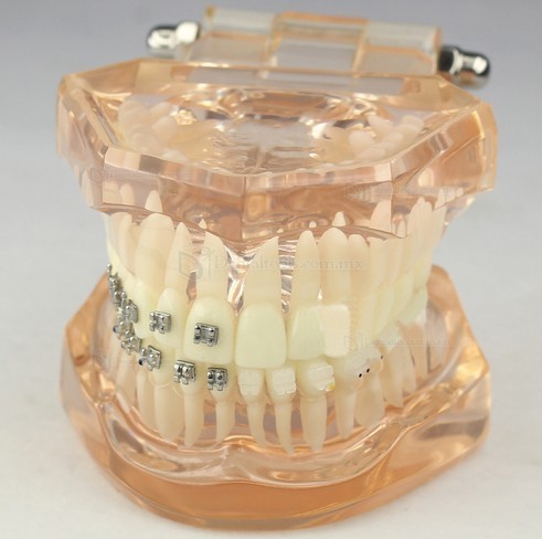 Modelo de ortodoncia con brackets cerámicos para demostración M3009 Modelo de ortodoncia con brackets cerámicos para demostración M3009