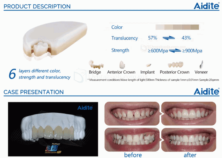 1PCS Material dental multicapa de la dentadura de los bloques del circón de la restauración estética Zirconia