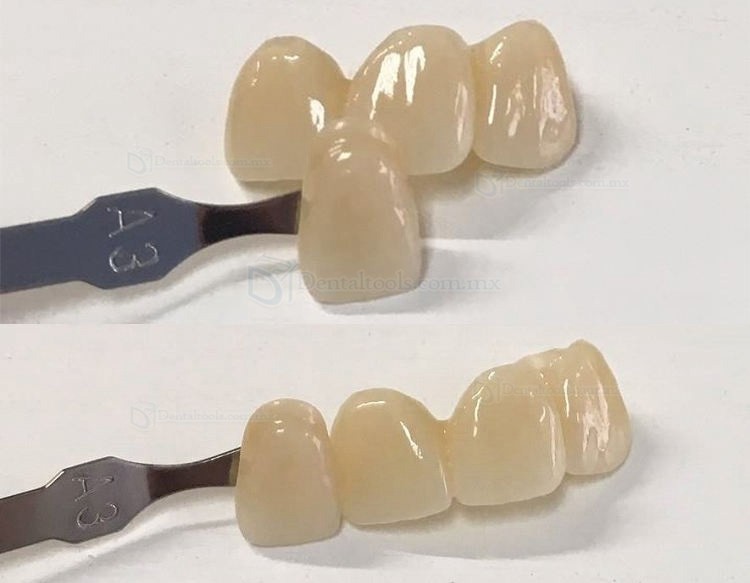 1PCS Material dental multicapa de la dentadura de los bloques del circón de la restauración estética Zirconia