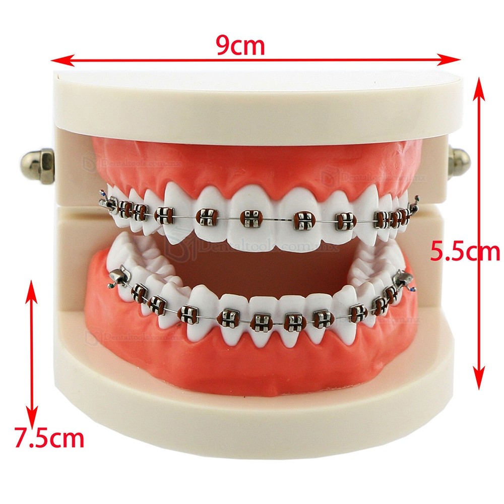 Modelo de ortodoncia con brackets metálicos cerámicos y autoligables con tubos y cadena elástica Modelo de ortodoncia con brackets metálicos cerámicos y autoligables con tubos y cadena elástica