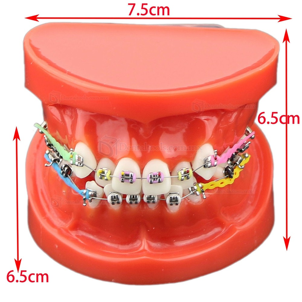 Modelo de ortodoncia con brackets metálicos cerámicos y autoligables con tubos y cadena elástica Modelo de ortodoncia con brackets metálicos cerámicos y autoligables con tubos y cadena elástica