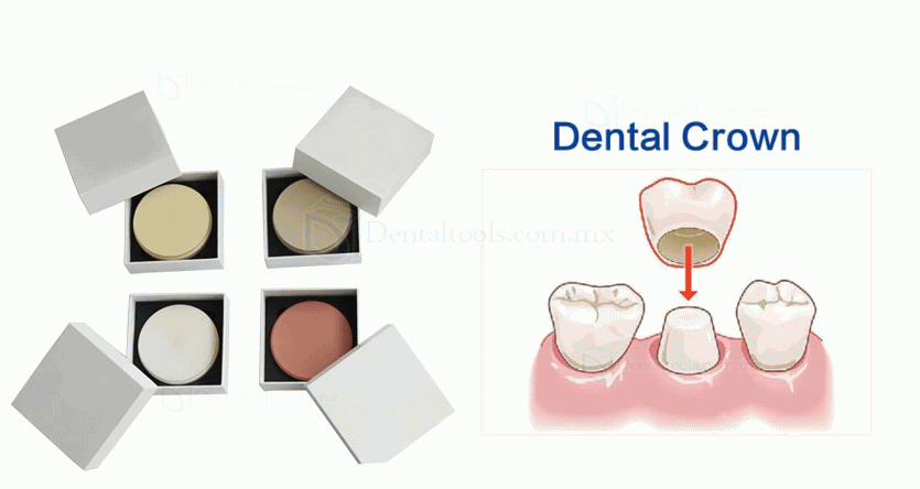 Bloques dentales PEEK para implantes Prótesis dentales Disco PEEK 98mm 95mm 12/14/16/18/20mm