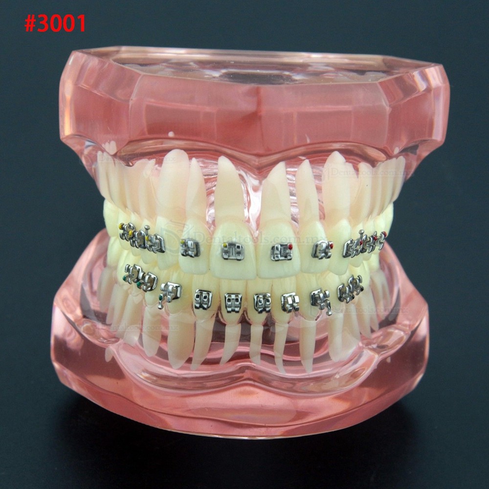 Modelo dental didáctico para demostración y práctica de ortodoncia Modelo dental didáctico para demostración y práctica de ortodoncia